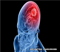 丈夫突發腦溢血，妻子撤回離婚訴訟