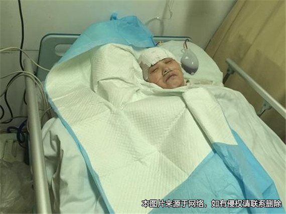 女兒不對植物人父親盡撫養義務，被判不能完全繼承父親的遺產