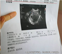丈夫以妻子兩次擅自流產(chǎn)為由起訴離婚并索要賠償